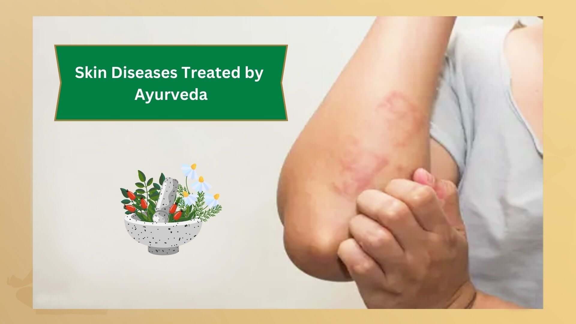 skin-diseases-treatment-in-ayurveda-in-australia