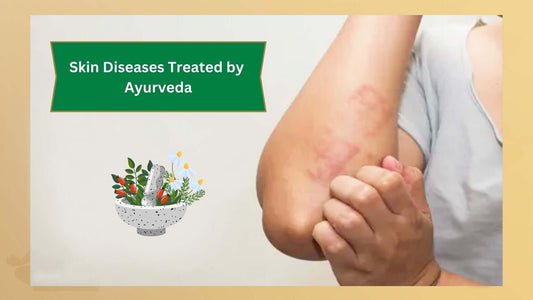 Skin Diseases Treatment in Ayurveda